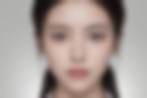 牙齿矫正的佳年龄是多少？医生告诉你