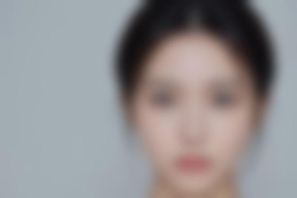 广州黑色素减少哪家医院？广州靠谱的黑色素减少医院推荐