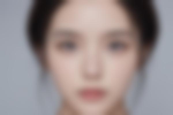 纹身去除的5种科学方法，你适合哪一种？