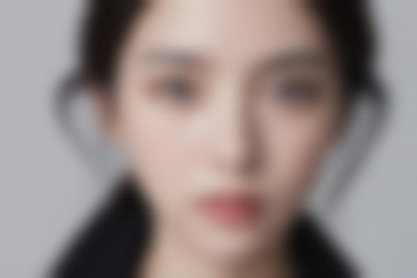 哈尔滨做双眼皮手术哪家医院好？这份医院名单请收好