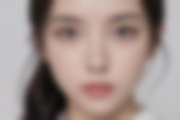 牙齿美白：快速改善笑容的利器