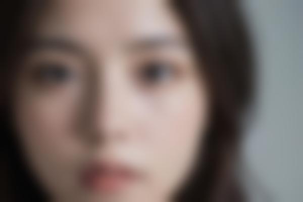 什么是绣线手术？绣线手术的与风险详解