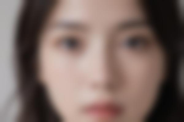 为什么选择双眼皮手术？