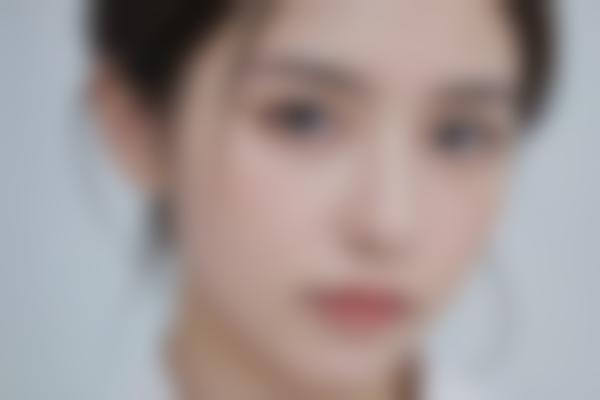 皮秒激光：新一代去纹身技术