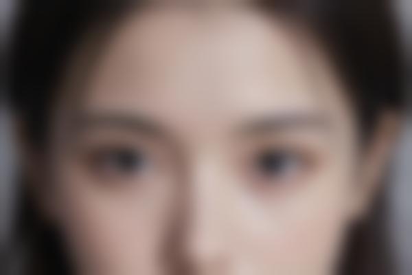 吸脂术的技术特点