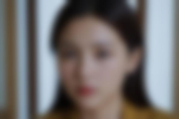 激光皮肤护理：科学焕肤的秘密与注意事项