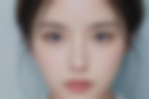 杭州虹桥医院整形怎么样？双眼皮、隆鼻、吸脂等热门项目价格及服务解析