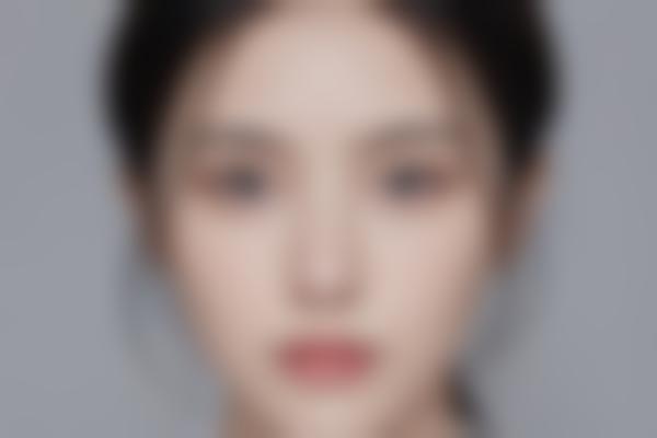 吸脂：细琢更有型