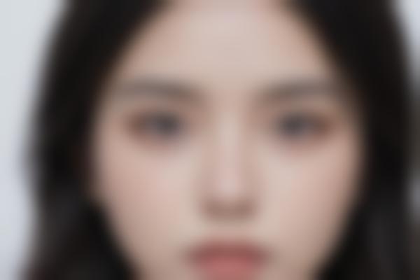 关于色素性皮肤疾病的常见疑问解答