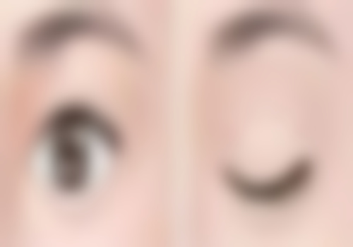 谭敏峰双眼皮真有那么美吗？没错！他打造的灵动双眼皮宛如天生，众多案例见证美到出圈的奇迹！ 