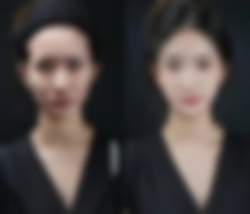 石家庄拾光薇整形医院口碑怎么样：好评如潮的美丽之选