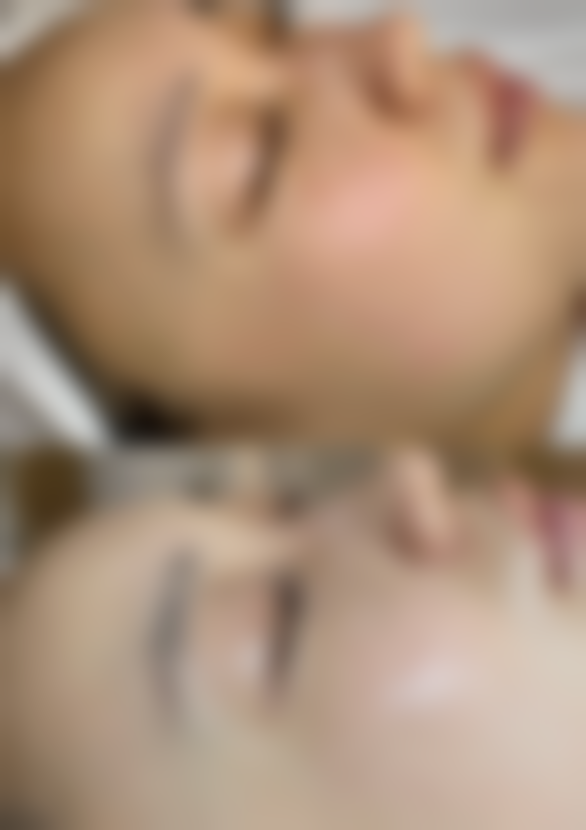 北京百达丽医疗美容预约挂号方式：便捷效率高，轻松开启美丽之旅