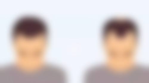 金华婺城口腔医院祛色素疤痕专精吗