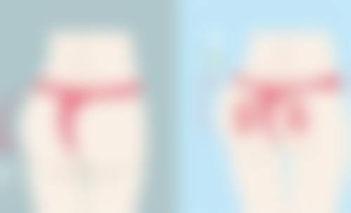 北京圣嘉新医疗美容医院做玻尿酸隆胸填充成效能保持多久靠谱吗？