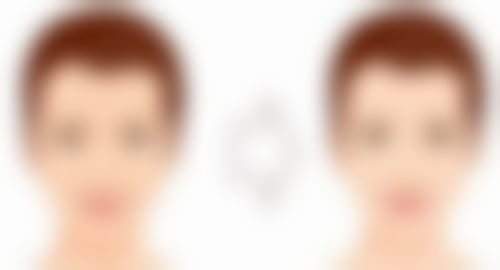 双眼皮和埋线哪个好？深入剖析两者优缺点、适应人群及恢复周期，助你选对美眼方式！ 