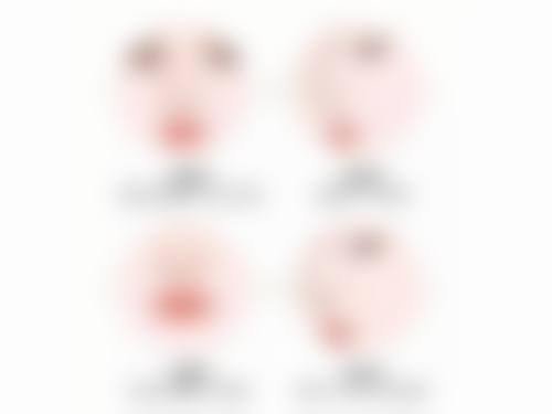 可痕类人胶原蛋白疤痕修复硅凝胶修复凹陷性手术疤痕靠谱吗？