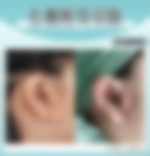 许昌正美韶华医疗整形真实实例