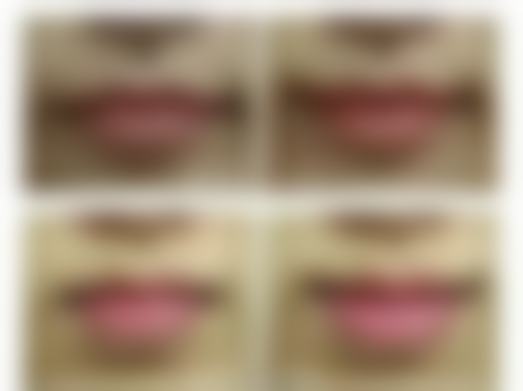 沈阳杏林整形割双眼皮和埋线哪个靠谱？