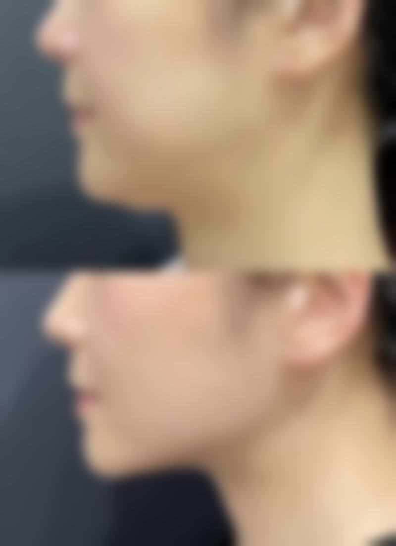 呼和浩特京美医疗美容医院祛色素疤痕靠谱吗