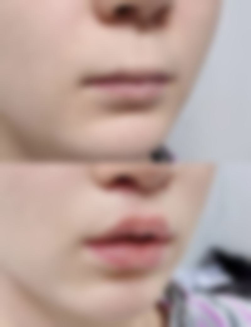 韦婷医生坐诊医院