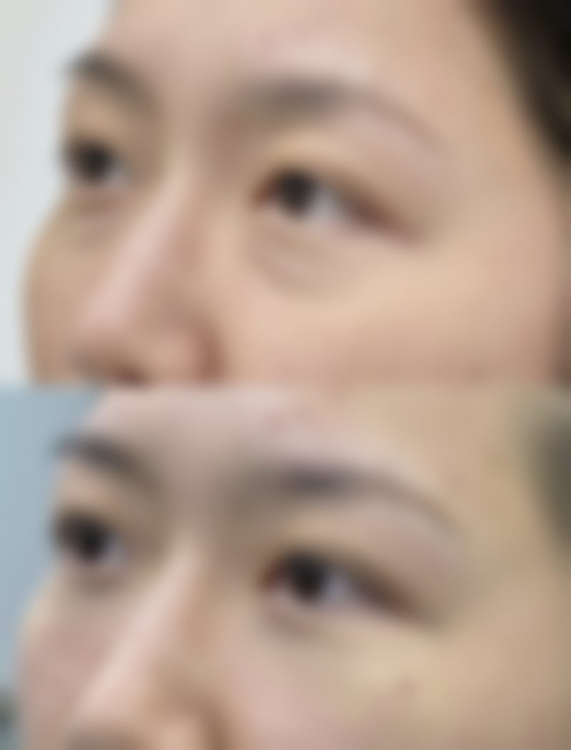 北京京韩医疗美容的超声乳化吸脂靠谱吗？