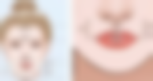 怎么去除脸上痘印疤痕？医美揭秘：3大热门项目、5个护理要点助你告别痘印疤痕烦恼！ 