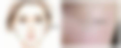 深圳艺星割双眼皮后吃草莓能减轻炎症靠谱吗？