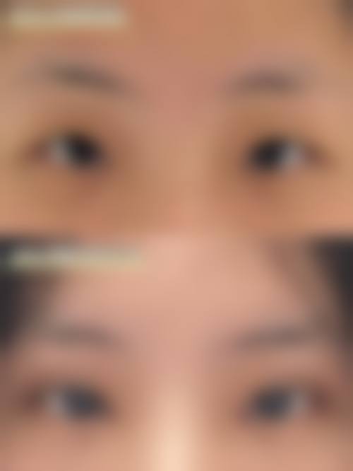 孝感华美医疗美容门诊部北京路店擅长项目