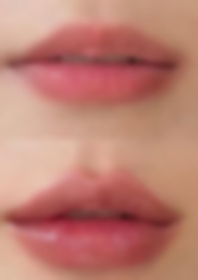 北京丽合医疗美容去除手术增生的疤痕成效怎么样