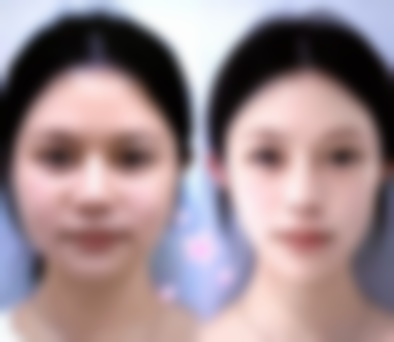 武汉若然整形医疗美容真实实例