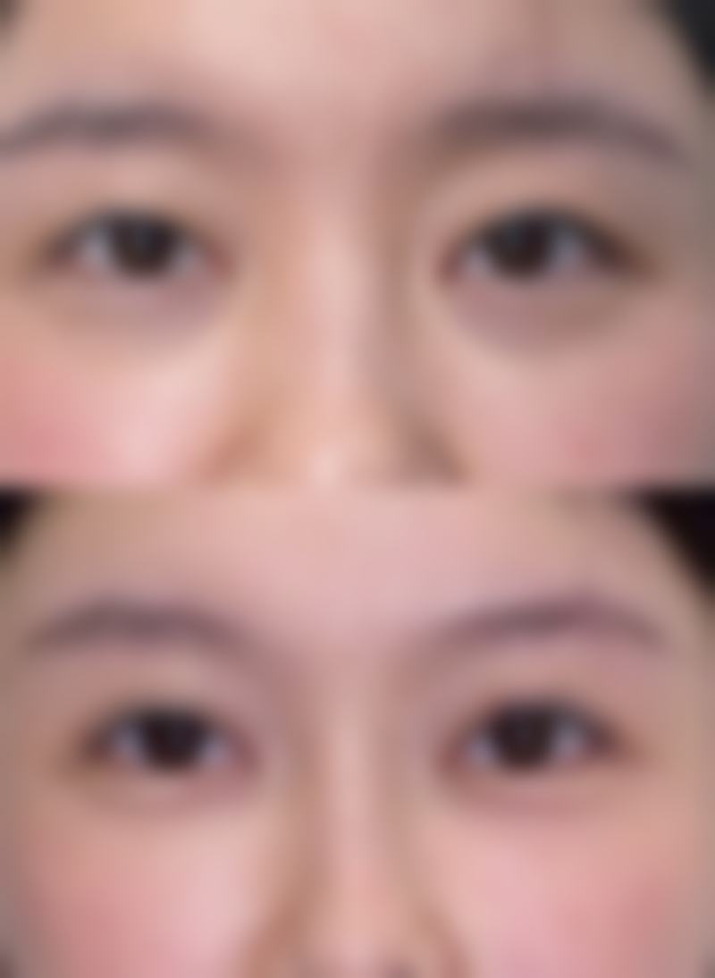 常见的疤痕修复膏成分安心性怎么样？