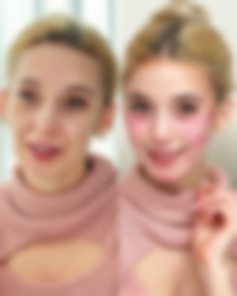 手术增生的疤痕怎么去除？权威医美专家揭秘4大有效方法，让增生疤痕不再顽固！ 