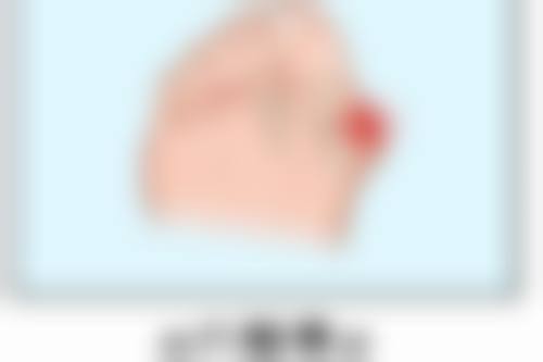 西安莲湖西交疤痕去除疤痕上的色素成效好吗？