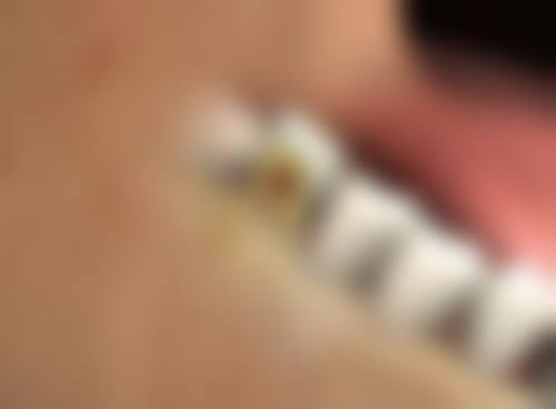 西安画美整形医院除皱能维持多长时间？靠谱吗？