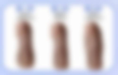 呼和浩特京美医疗美容医院做双眼皮修复时间怎么样