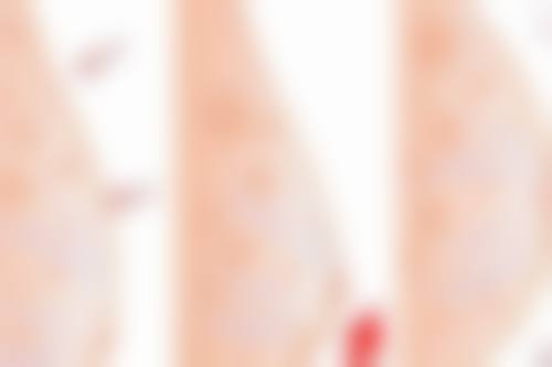 石家庄恩馨恩喜医疗美容门诊部口碑怎么样