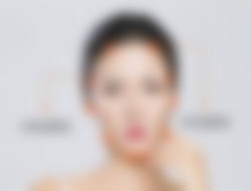 苏州维秘整形医院真实实例:见证美丽奇迹