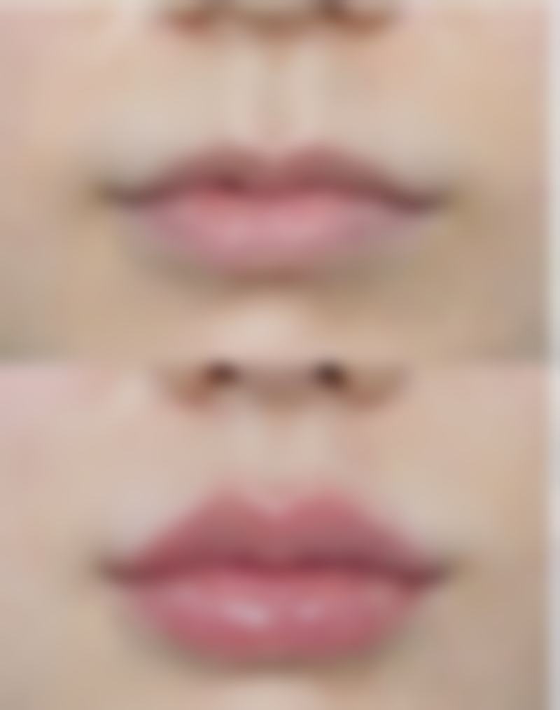 北京嘉禾医疗美容做双眼皮修复适合吗