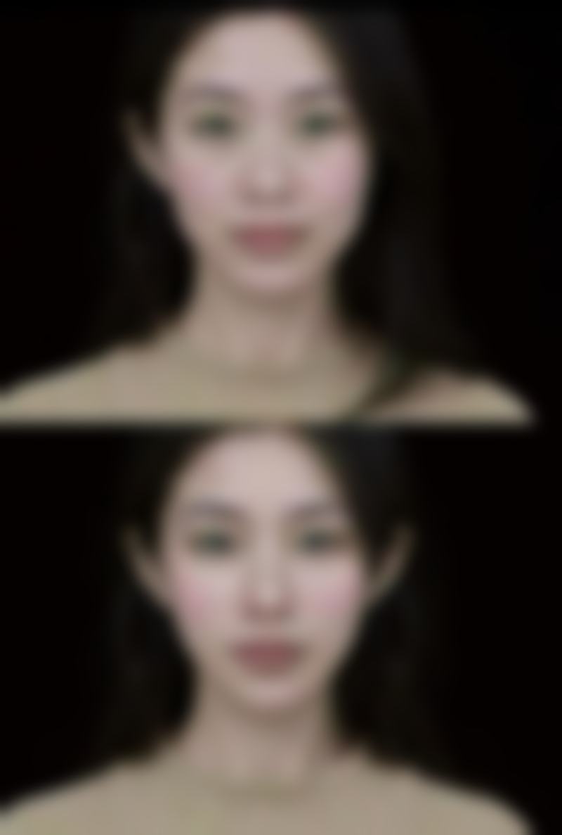 西安画美医疗美容医院的手术疤痕止痒药能有效止痒吗？