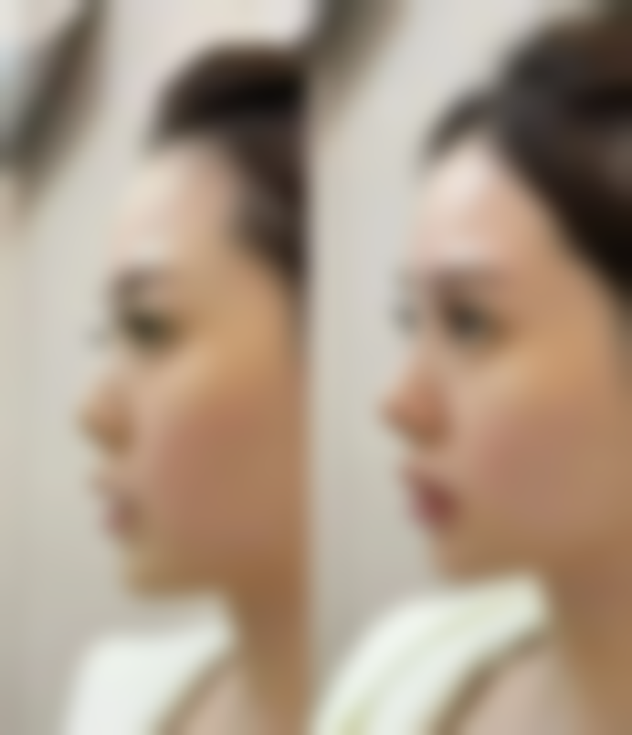 武科 大附属紫荆医院医疗美容科做双眼皮修复靠谱吗