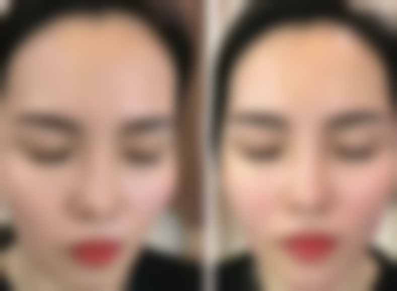 茂名雨蔓医疗美容诊所价格表