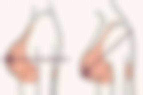 武汉雅偲整形医院价格表:透明合理