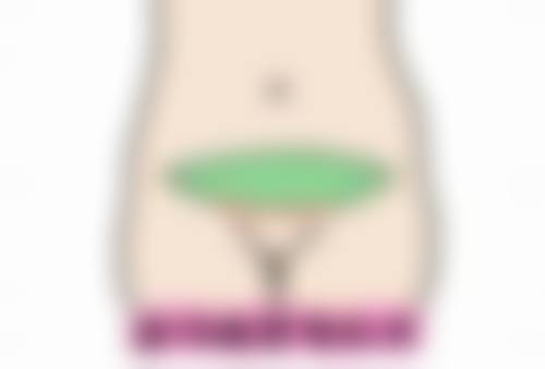 北京画美医疗美容割双眼皮修复时间适合上班族吗？