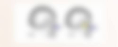 苏州紫馨整形医院打瘦脸针后皮肤紧绷感正常吗