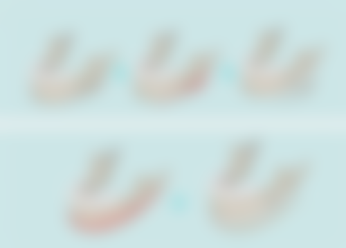 割双眼皮大概多久能恢复？全面揭秘3大快速恢复妙招，让你2周实现美丽蜕变！ 