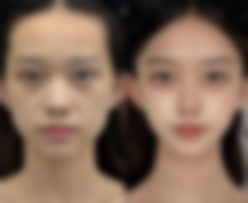 绍兴亚韩医疗美容诊所仪器设备：精良科技助力变得更美