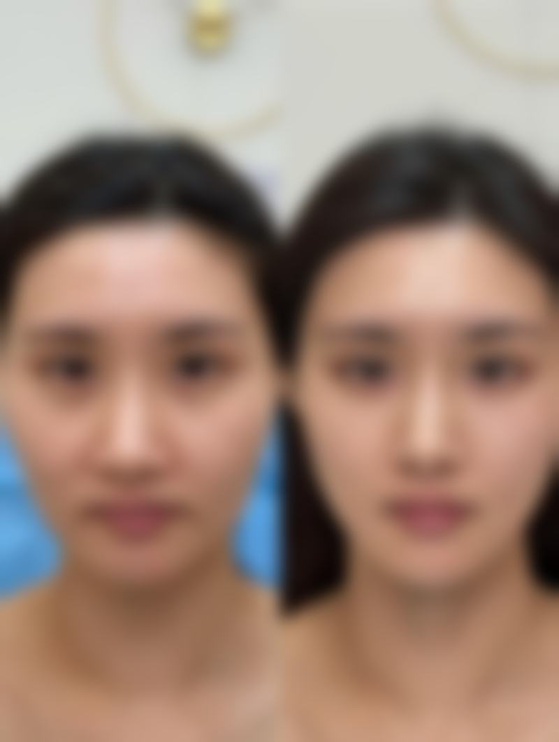 丸美双胶原眼霜淡化眼袋适合什么肤质