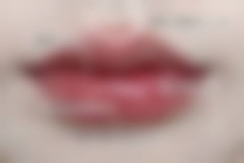 沈阳杏林整形消除缝合后疤痕靠谱吗？