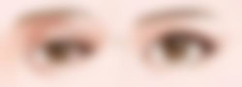 王传凯医生真实实例:见证神奇的毛发蜕变