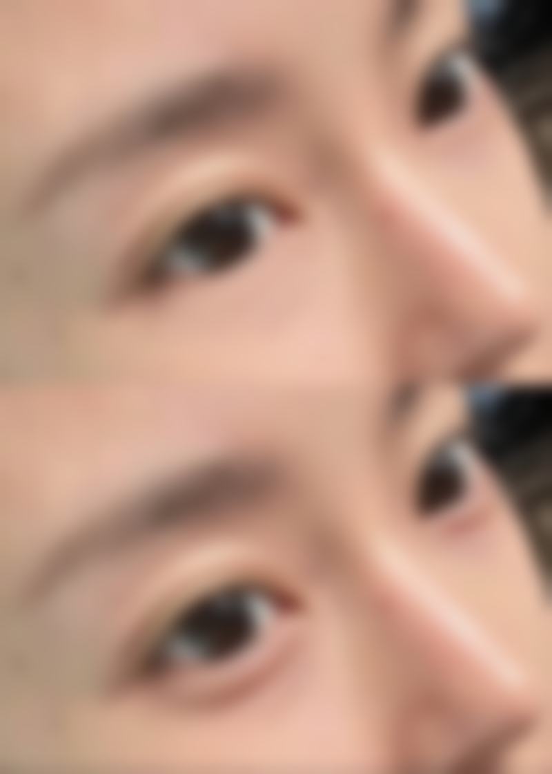 I contact整形外科医生团队：专注眼部20年的骨干医生